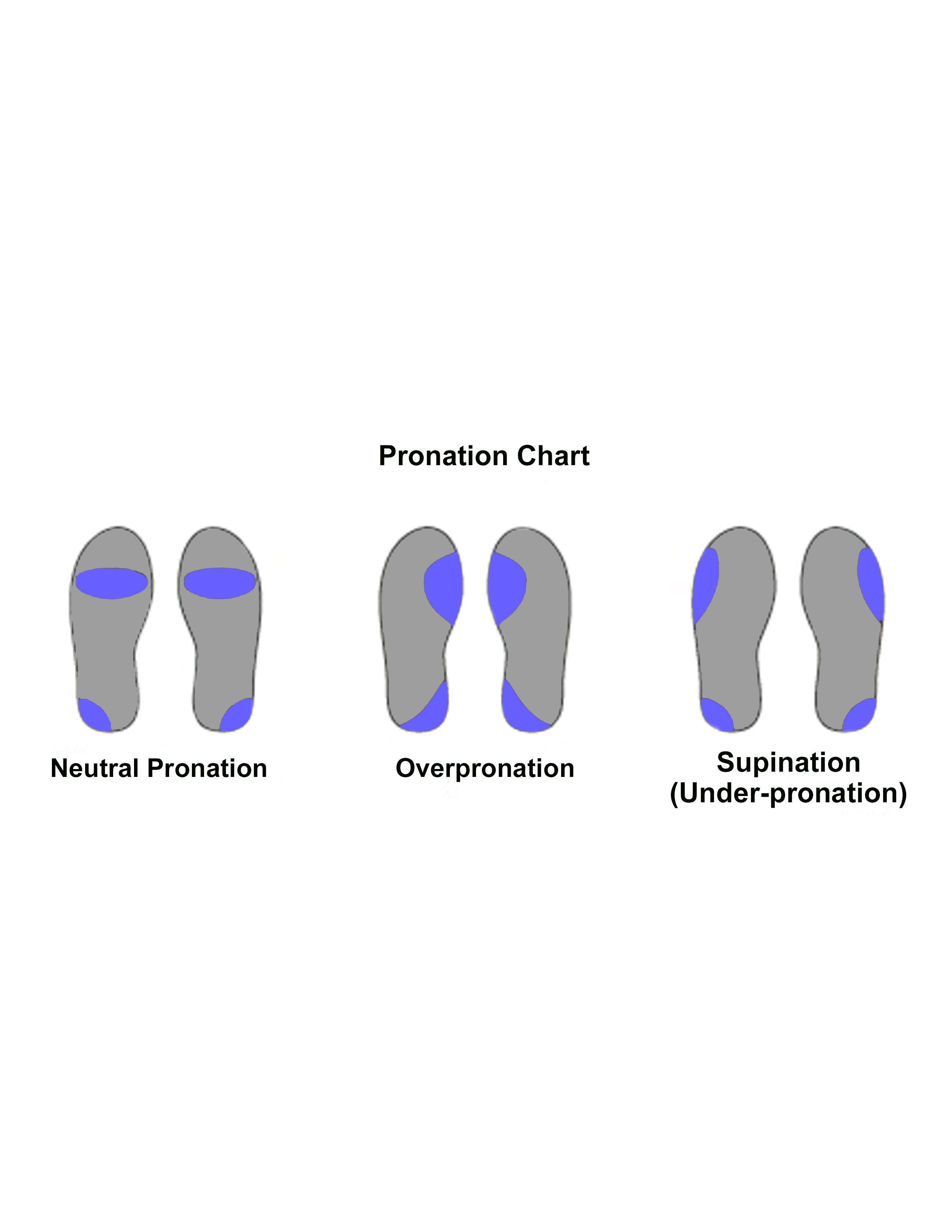 pronation shoes meaning